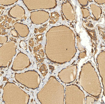 Citrin/SLC25A13 Rabbit Polyclonal Antibody