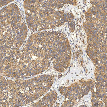 Citrin/SLC25A13 Rabbit Polyclonal Antibody