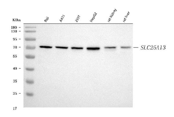 Citrin/SLC25A13 Rabbit Polyclonal Antibody