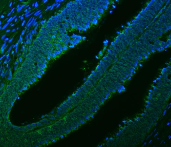 Citrin/SLC25A13 Rabbit Polyclonal Antibody