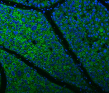 Citrin/SLC25A13 Rabbit Polyclonal Antibody
