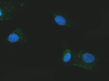 Citrin/SLC25A13 Rabbit Polyclonal Antibody