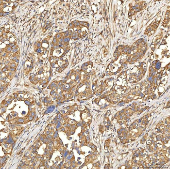 Citrin/SLC25A13 Rabbit Polyclonal Antibody