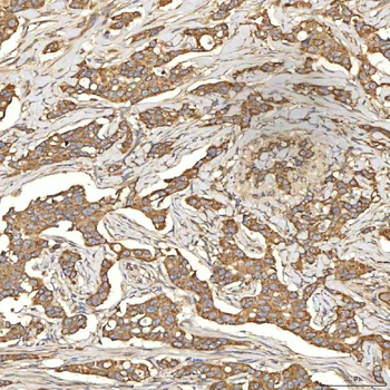 Citrin/SLC25A13 Rabbit Polyclonal Antibody