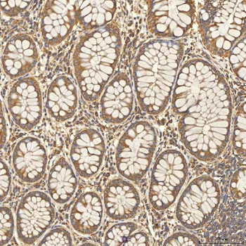 Citrin/SLC25A13 Rabbit Polyclonal Antibody