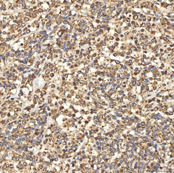 Citrin/SLC25A13 Rabbit Polyclonal Antibody