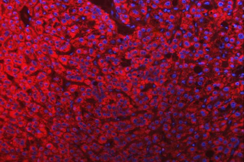 Mitochondrial dicarboxylate carrier/SLC25A10 Rabbit Polyclonal Antibody