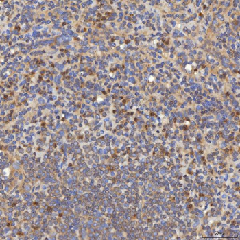 Mitochondrial dicarboxylate carrier/SLC25A10 Rabbit Polyclonal Antibody