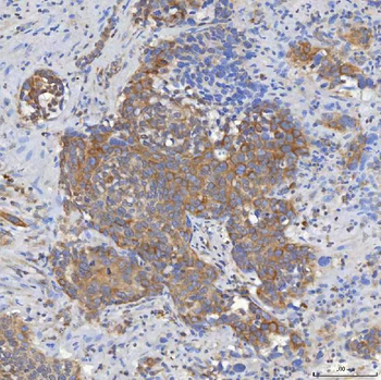 Mitochondrial dicarboxylate carrier/SLC25A10 Rabbit Polyclonal Antibody