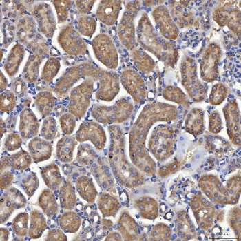 Mitochondrial dicarboxylate carrier/SLC25A10 Rabbit Polyclonal Antibody