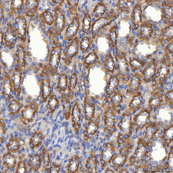 Mitochondrial dicarboxylate carrier/SLC25A10 Rabbit Polyclonal Antibody