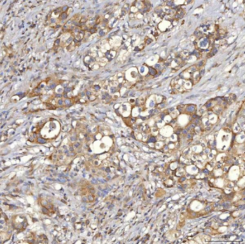 Mitochondrial dicarboxylate carrier/SLC25A10 Rabbit Polyclonal Antibody