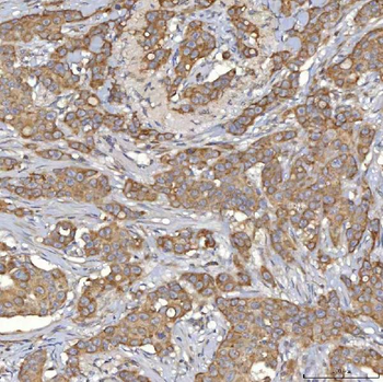 Mitochondrial dicarboxylate carrier/SLC25A10 Rabbit Polyclonal Antibody