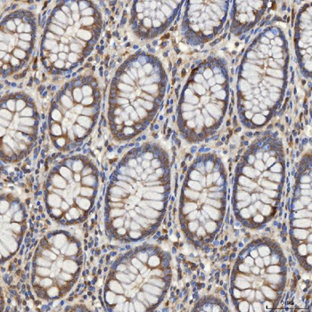 Mitochondrial dicarboxylate carrier/SLC25A10 Rabbit Polyclonal Antibody