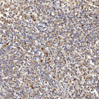 Mitochondrial dicarboxylate carrier/SLC25A10 Rabbit Polyclonal Antibody