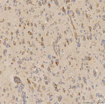 Mitochondrial dicarboxylate carrier/SLC25A10 Rabbit Polyclonal Antibody