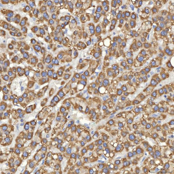 Mitochondrial dicarboxylate carrier/SLC25A10 Rabbit Polyclonal Antibody