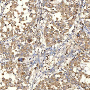 Mitochondrial dicarboxylate carrier/SLC25A10 Rabbit Polyclonal Antibody