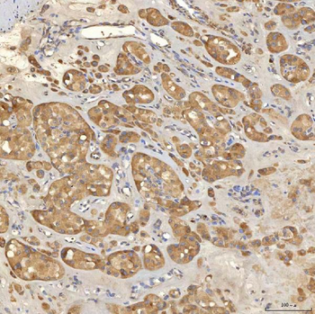 Mitochondrial dicarboxylate carrier/SLC25A10 Rabbit Polyclonal Antibody