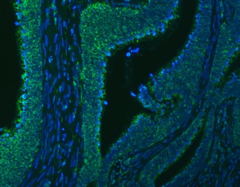 SLC20A1 Rabbit Polyclonal Antibody