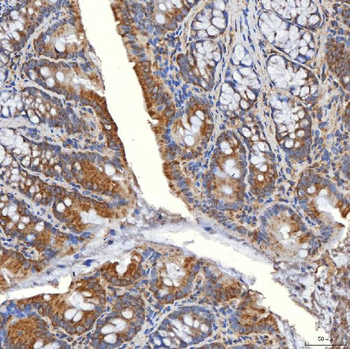 SLC20A1 Rabbit Polyclonal Antibody