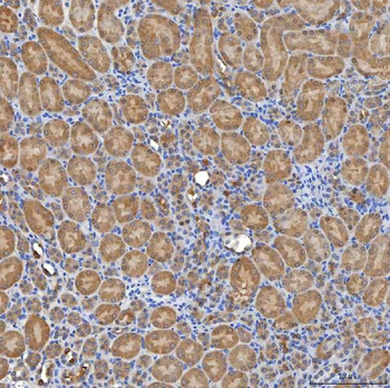SLC20A1 Rabbit Polyclonal Antibody