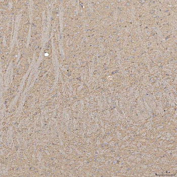SLC20A1 Rabbit Polyclonal Antibody