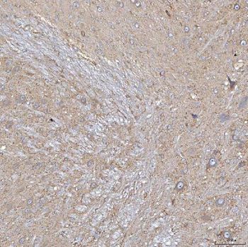 SLC20A1 Rabbit Polyclonal Antibody