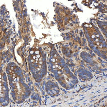 SLC20A1 Rabbit Polyclonal Antibody