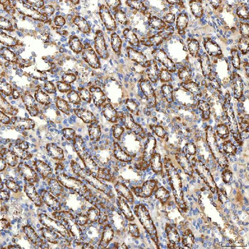 SLC20A1 Rabbit Polyclonal Antibody