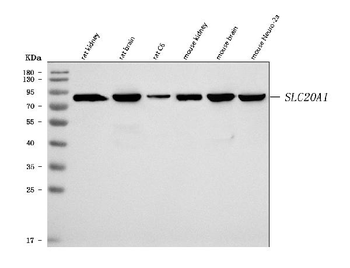 SLC20A1 Rabbit Polyclonal Antibody
