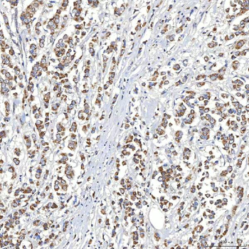 SLC20A1 Rabbit Polyclonal Antibody