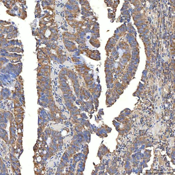 SLC20A1 Rabbit Polyclonal Antibody