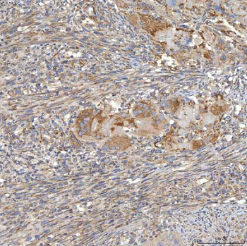SLC20A1 Rabbit Polyclonal Antibody