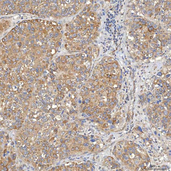 SLC20A1 Rabbit Polyclonal Antibody