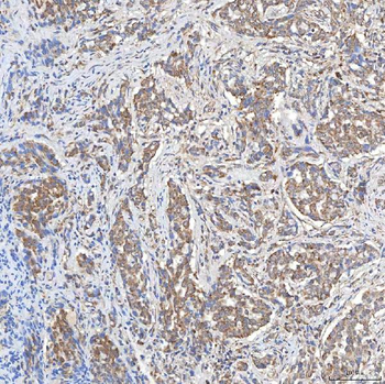 SLC20A1 Rabbit Polyclonal Antibody