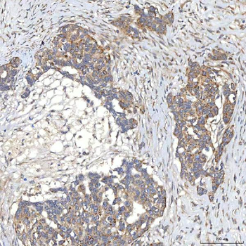 SLC20A1 Rabbit Polyclonal Antibody