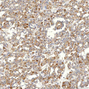 SLC20A1 Rabbit Polyclonal Antibody