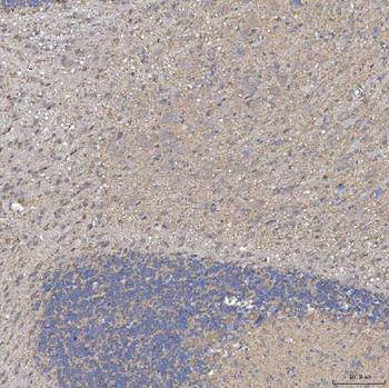 SLC20A1 Rabbit Polyclonal Antibody