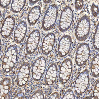 SIAE Rabbit Polyclonal Antibody