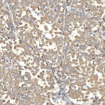 SIAE Rabbit Polyclonal Antibody