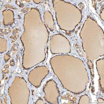 SIAE Rabbit Polyclonal Antibody