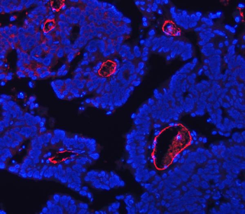 CD105/ENG Rabbit Polyclonal Antibody