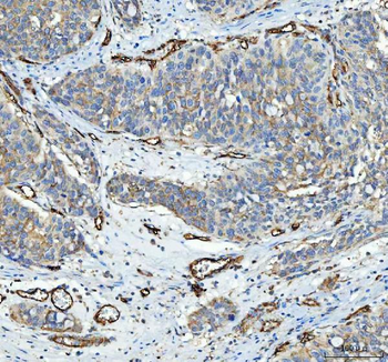 CD105/ENG Rabbit Polyclonal Antibody