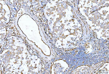CD105/ENG Rabbit Polyclonal Antibody