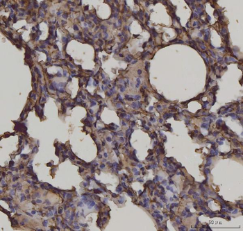 RAGE/AGER Mouse Monoclonal Antibody