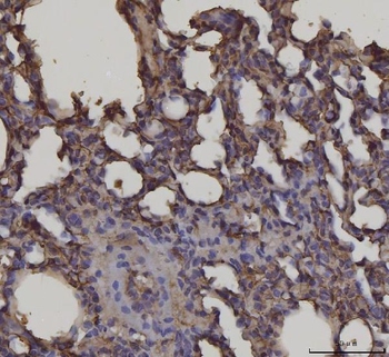 RAGE/AGER Mouse Monoclonal Antibody