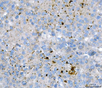 KLHL12 Mouse Monoclonal Antibody