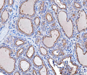 KLHL12 Mouse Monoclonal Antibody