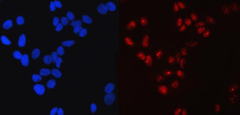 SP1 Mouse Monoclonal Antibody